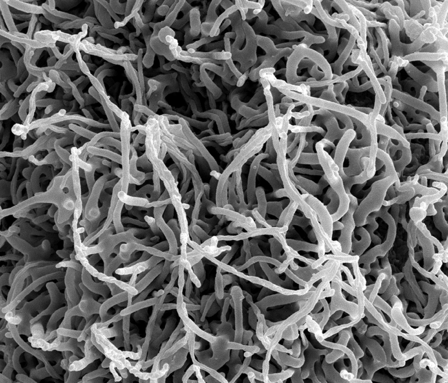 Produced by the National Institute of Allergy and Infectious Diseases (NIAID), under a magnification of 50,000X, this scanning electron micrograph (SEM) depicts numerous filamentous Ebola virus particles replicating from an infected VERO E6 cell.