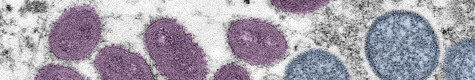 Digitally colorized electron microscopic (EM) image depicting a monkeypox virion (virus particle). 